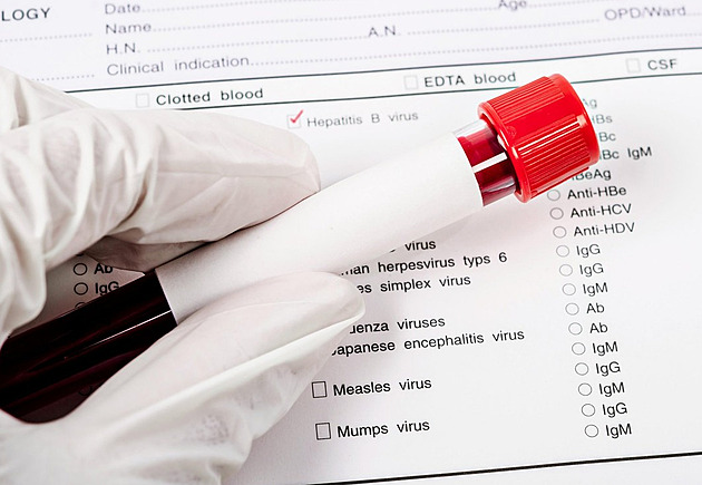 Infekční žloutenka na pracovišti. Jak ochránit sebe i ostatní