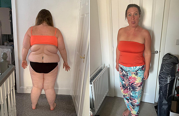 Žena se po letech zbavila obezity jen díky daru od otce